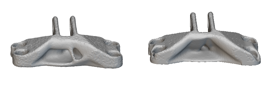 The Body on the left was generated without an Overhang Constraint and the body on the right was generated with an Overhang Constraint of 45 degrees.